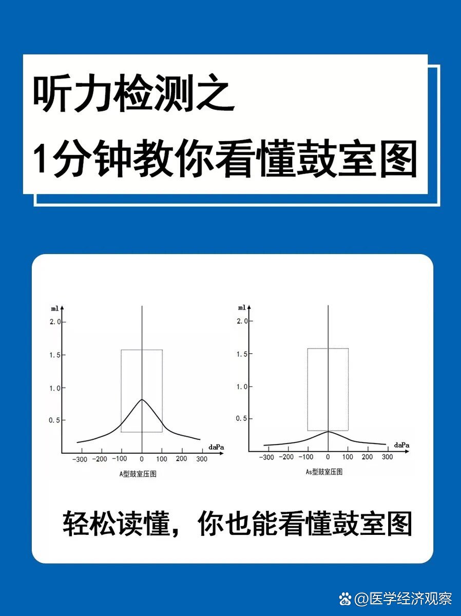 一分钟教你看懂听力测试中的鼓室图
