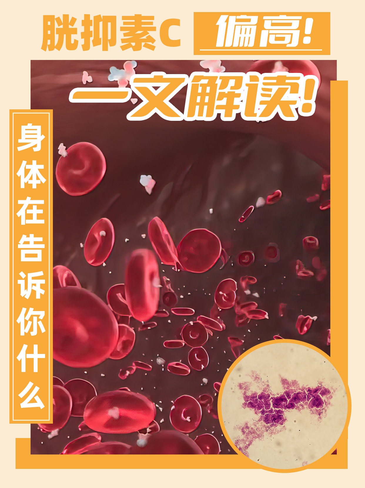 胱抑素c偏高,身体在告诉你什么?一文解读!