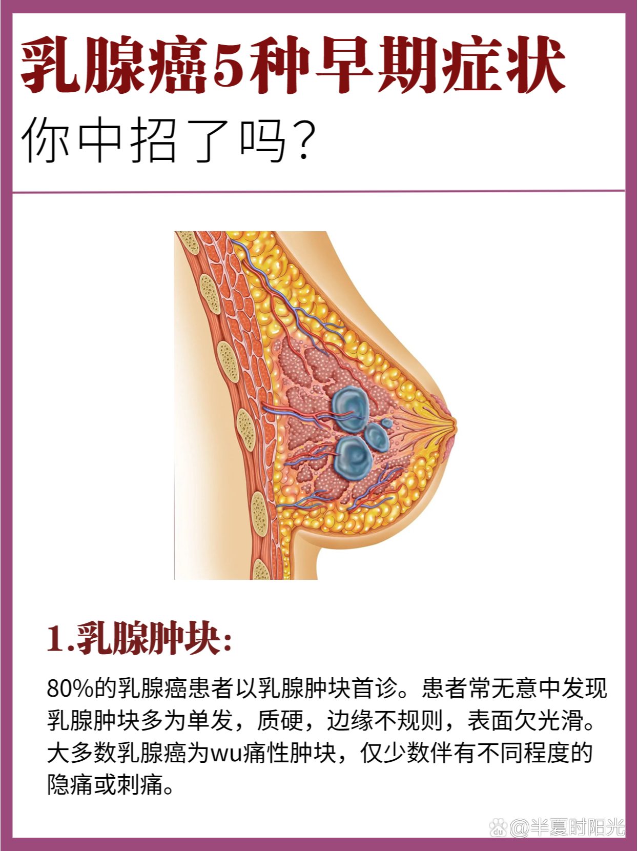 乳腺癌5种早期症状7515