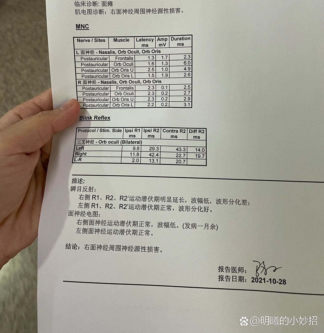 面神经肌电图结果解读图片