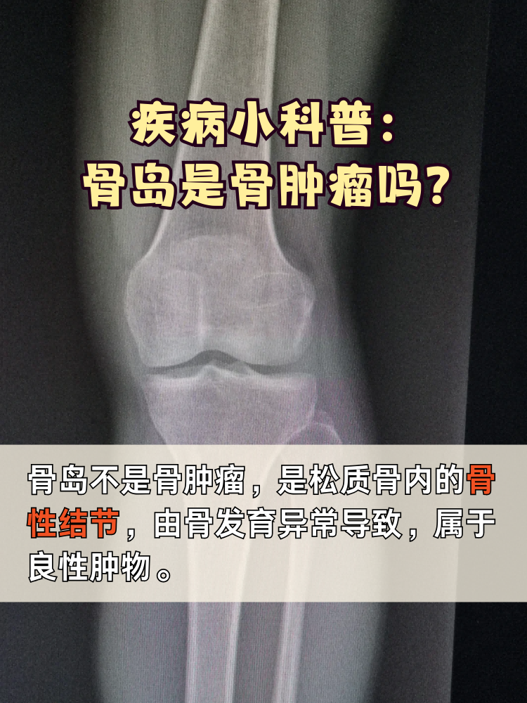 骨病=骨病疼痛最好的解决办法