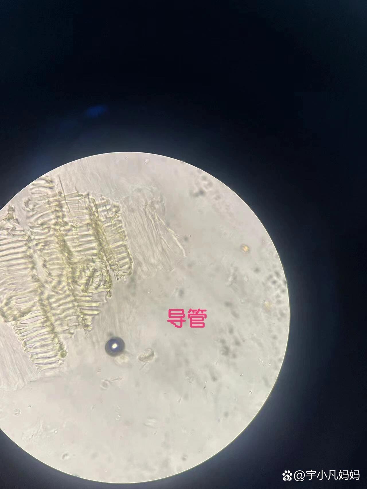 大黄粉末显微鉴别图