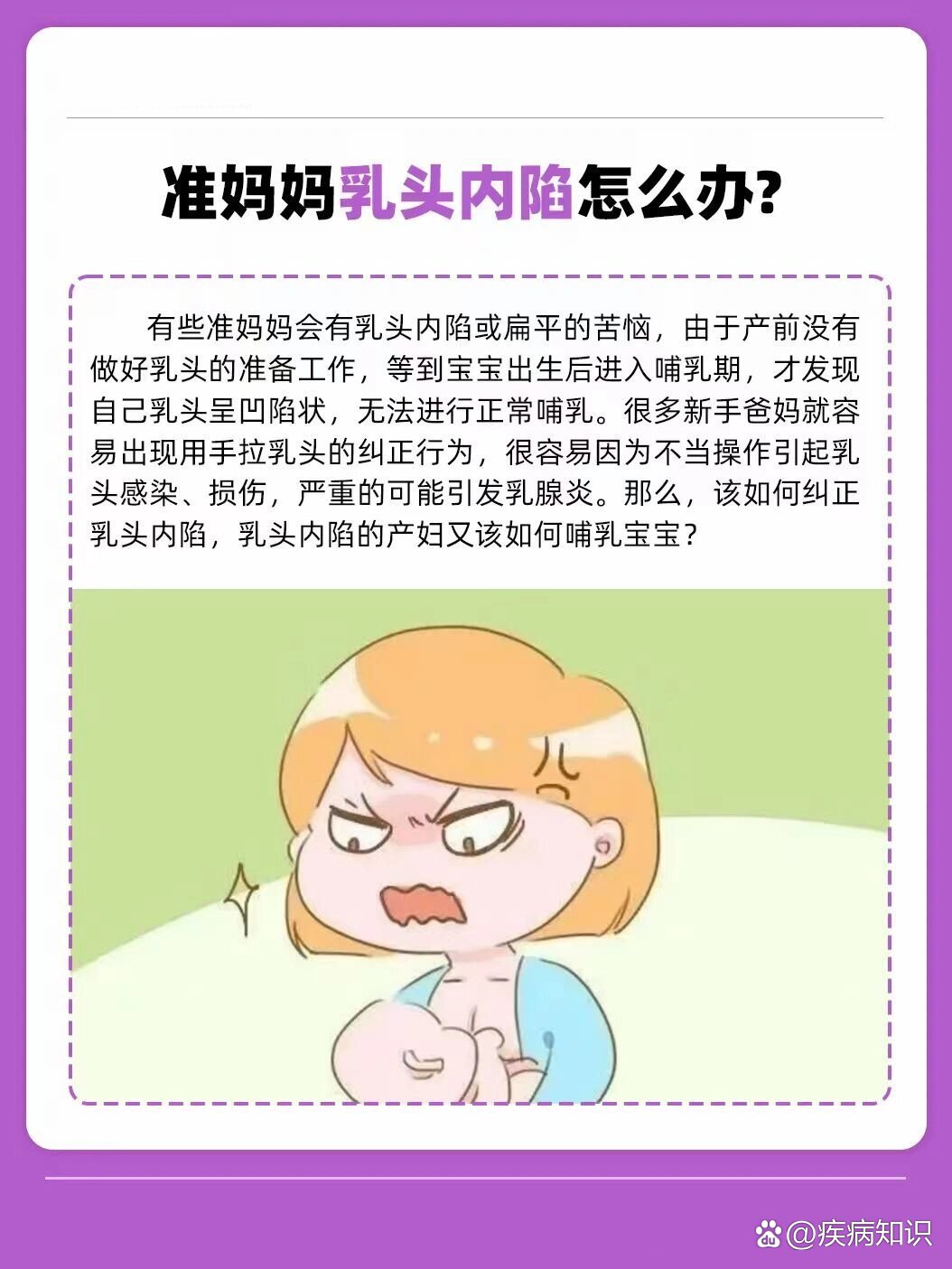 准妈妈乳头内陷怎么办7215有什么矫正方法02