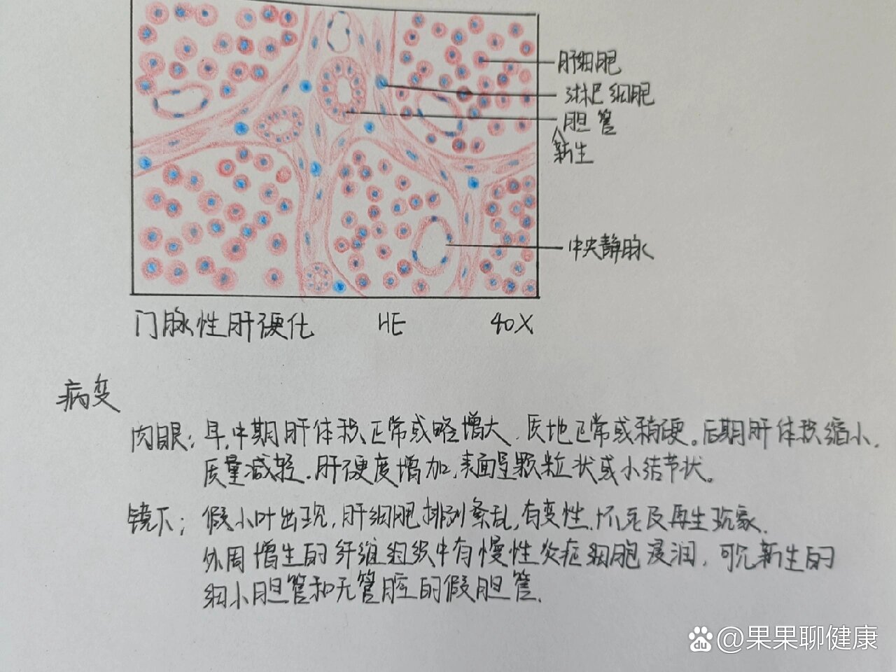 肝硬化手绘图实验报告图片