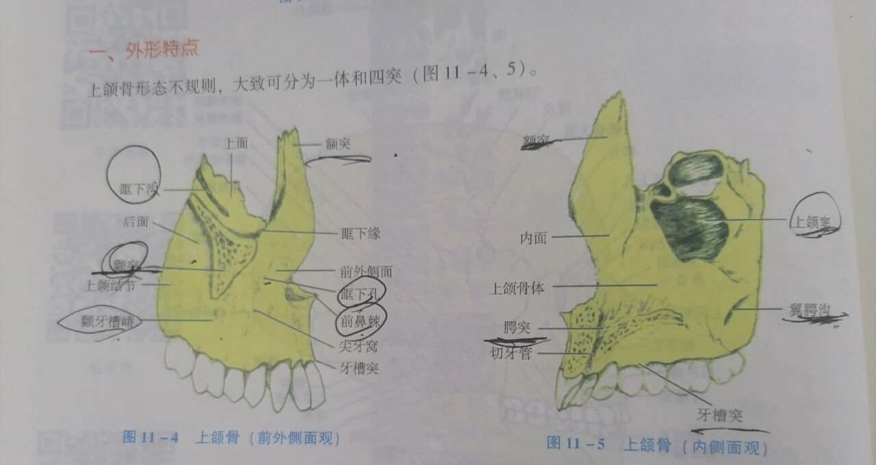 上颌骨额突图片图片