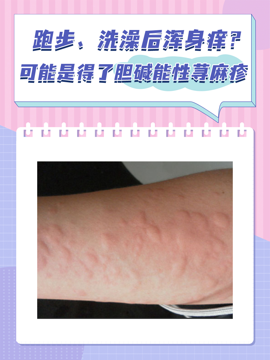 为什么全身会痒