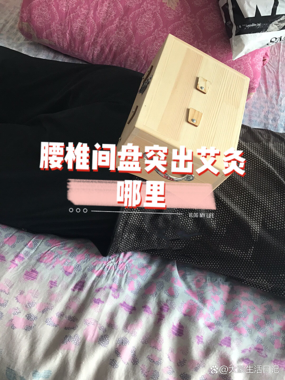 腰椎间盘突出艾灸哪里