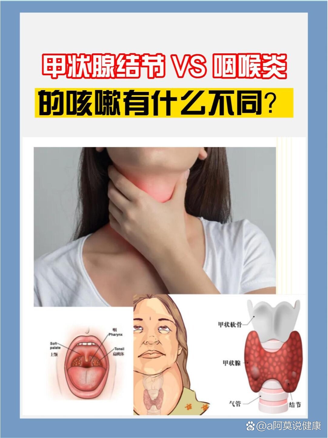 喉咙痛甲状腺图片