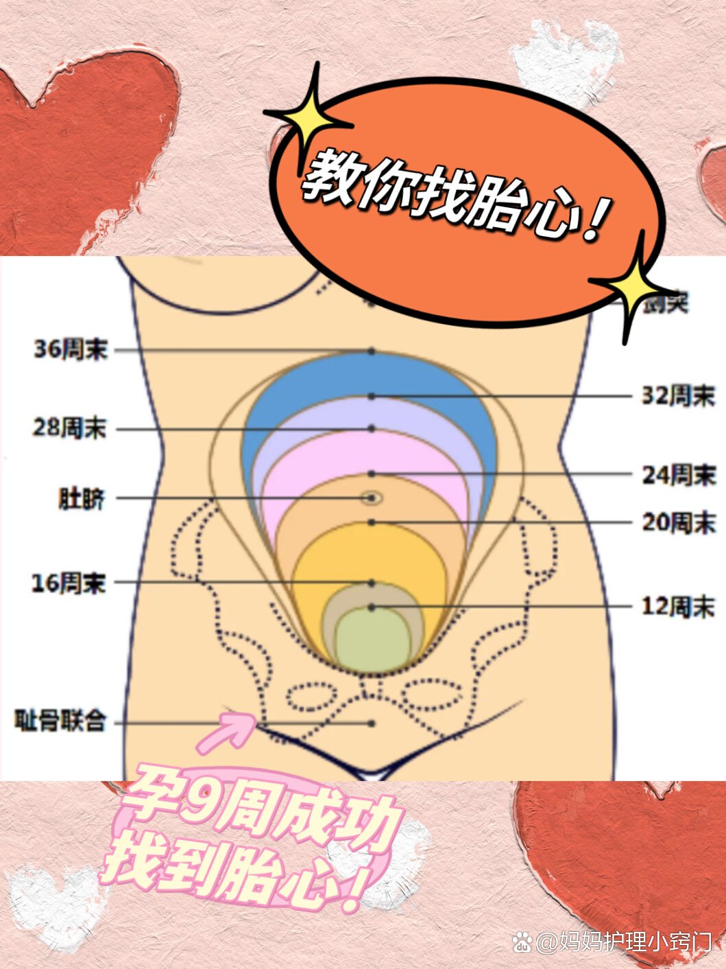 孕9周子宫位置图图片