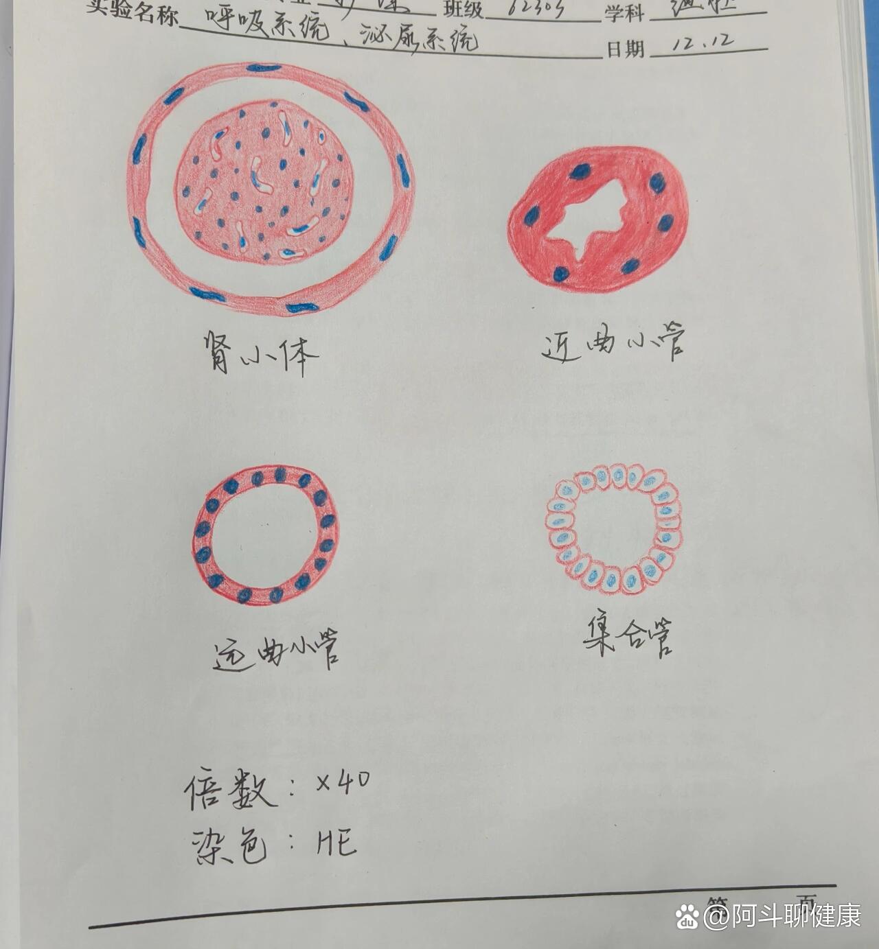 肠伤寒红蓝铅笔图图片