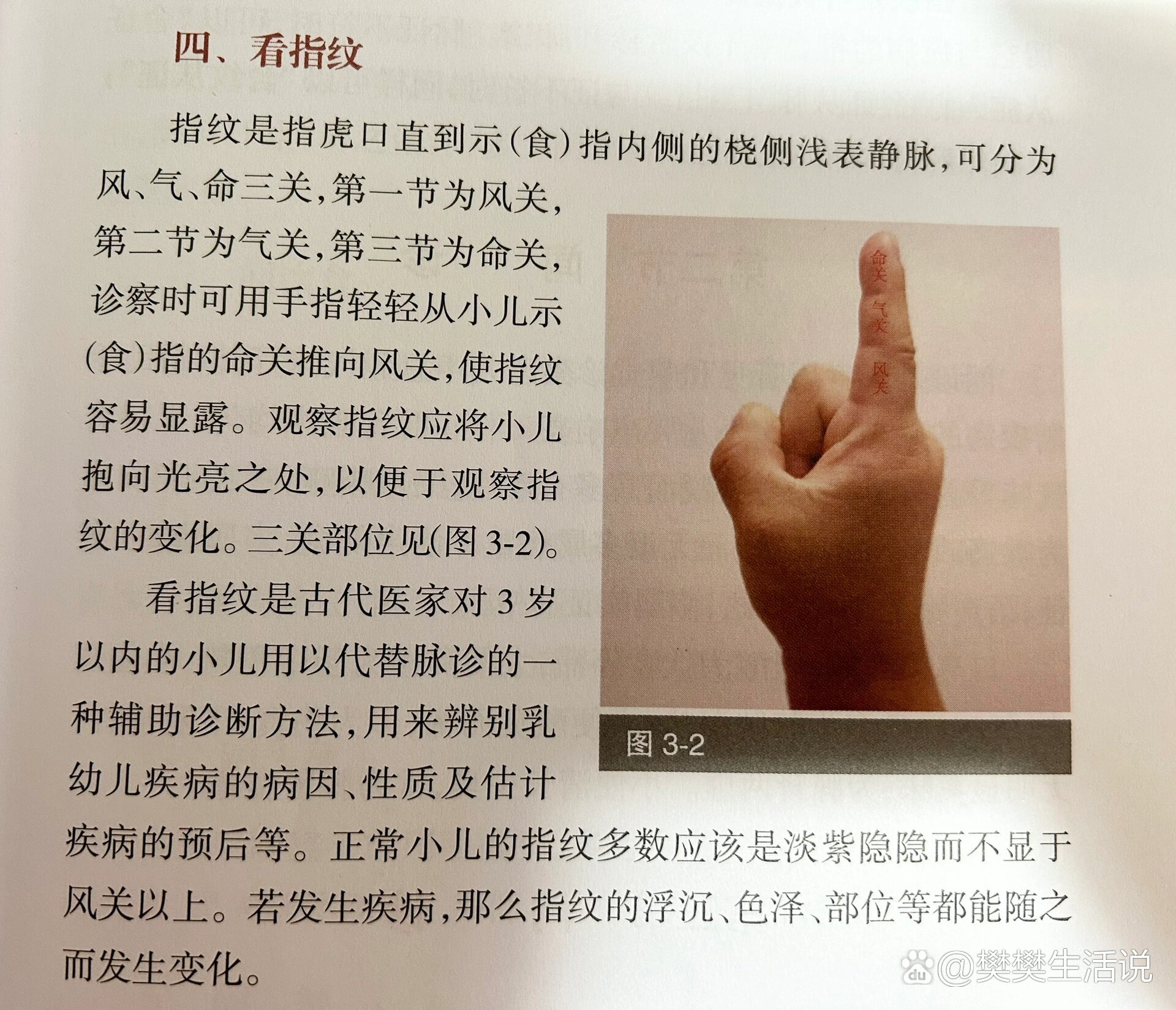 >看指纹是古代医家对 3岁以内的小儿用以代替脉诊的一种辅助诊断方法