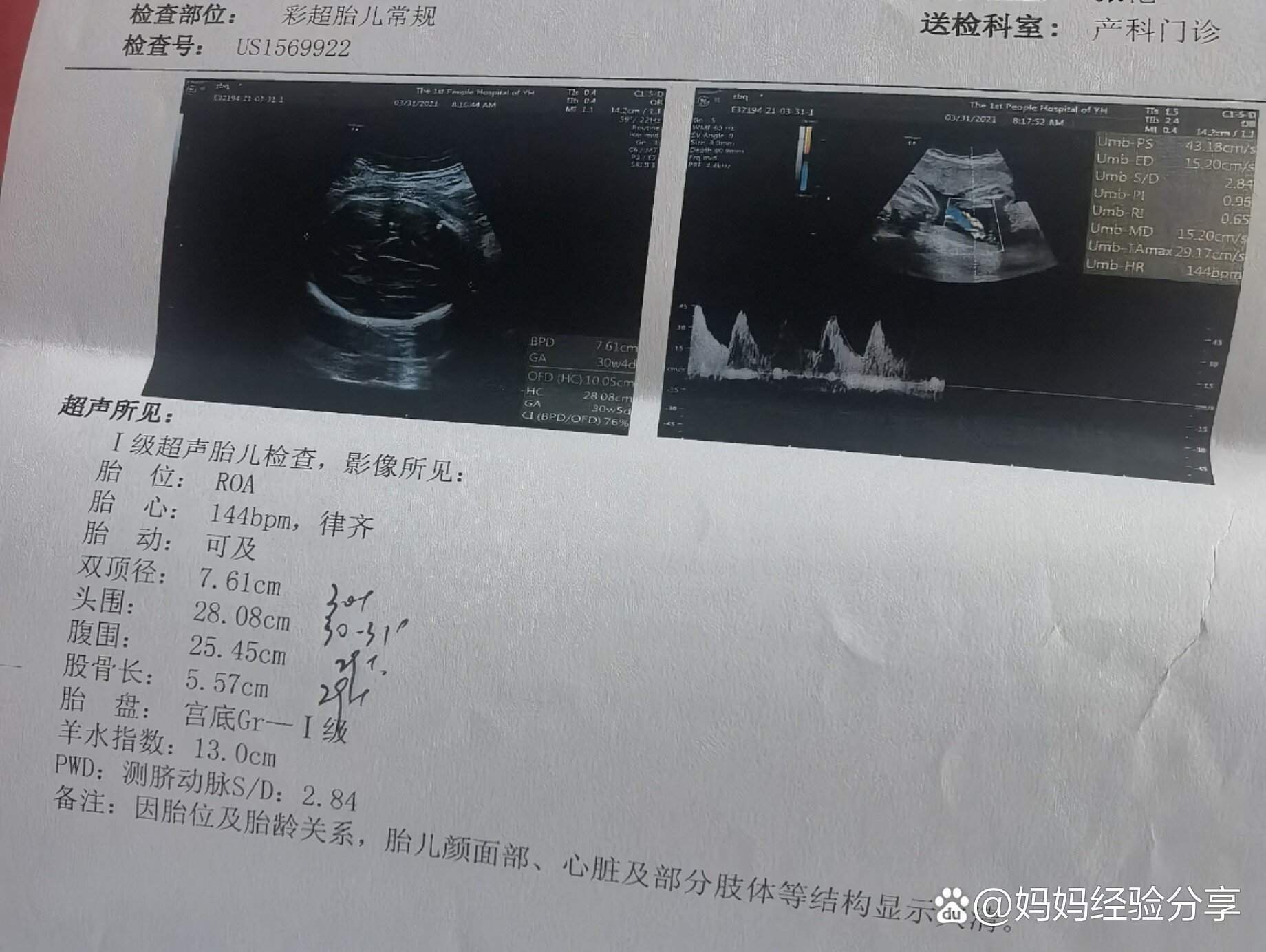 胎儿偏大两周太难了,怀孕之后感觉自己真的是女超人前期