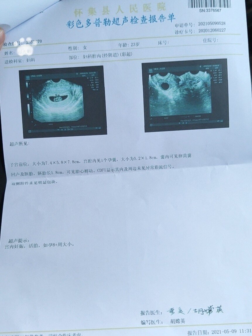孕8周了