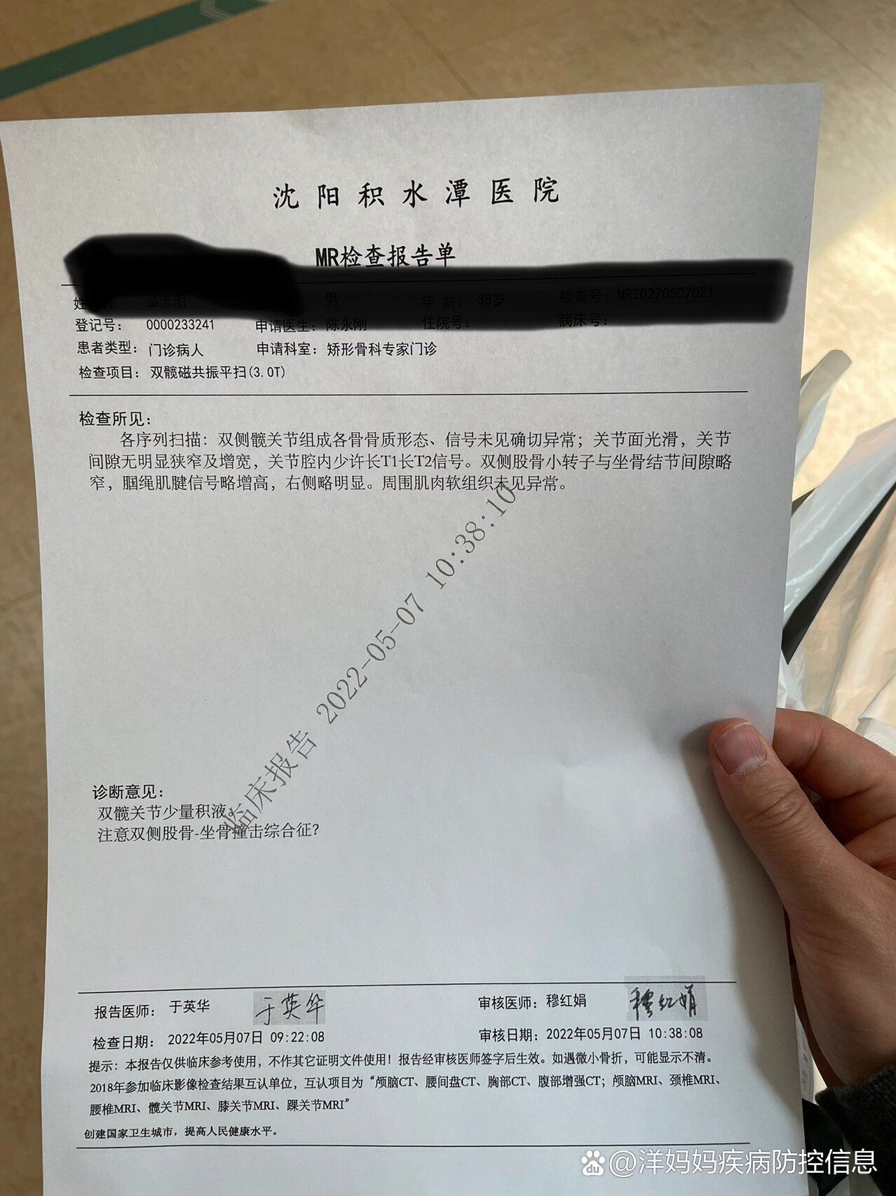 积水潭医院核磁加急找黄牛