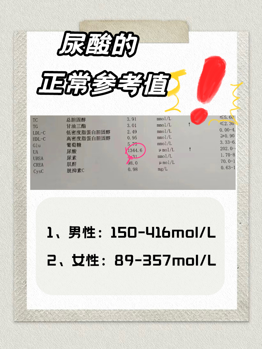 尿酸高是什么原因?看这篇你就知道了!