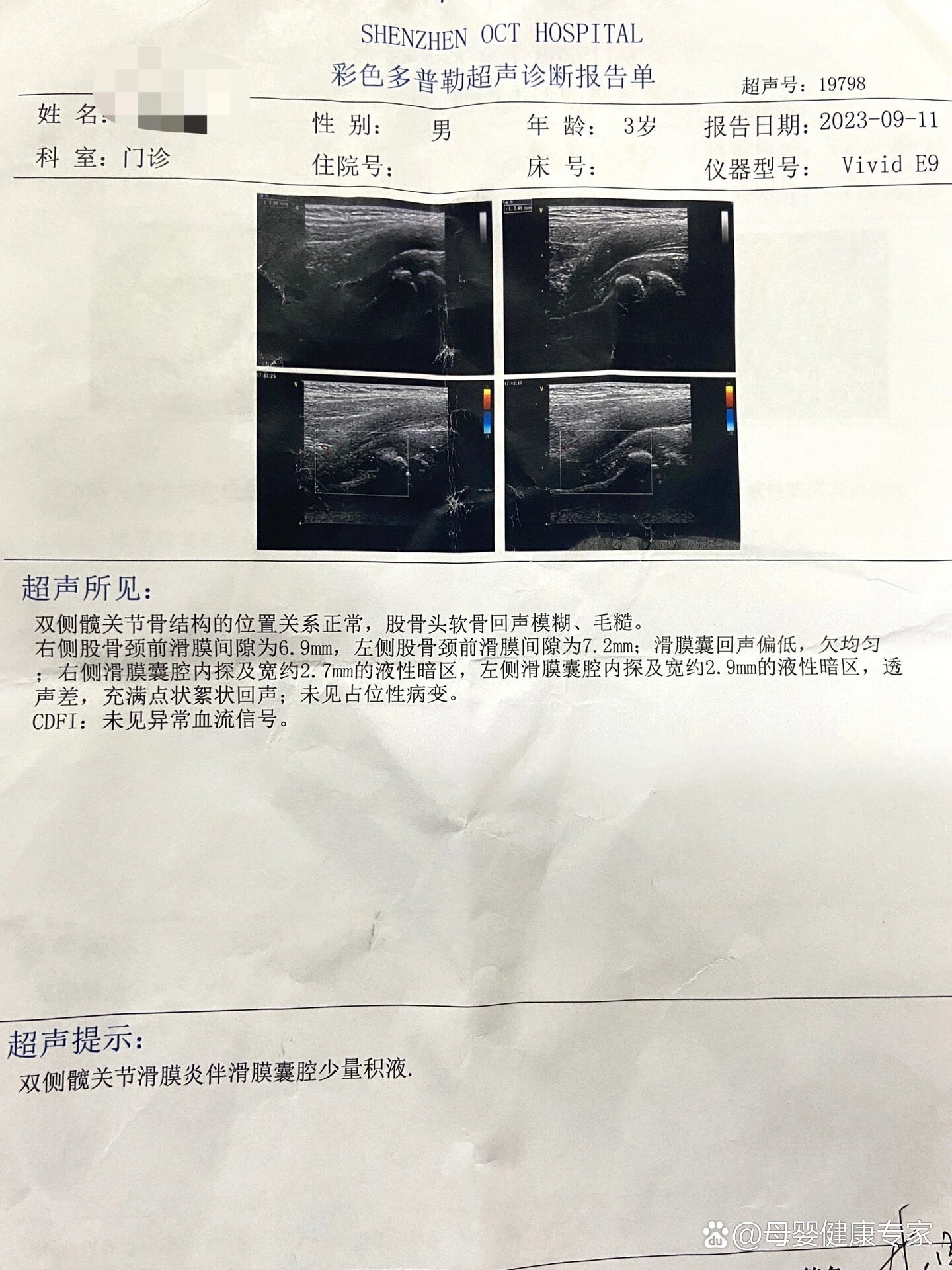 膝关节积液超声报告图片