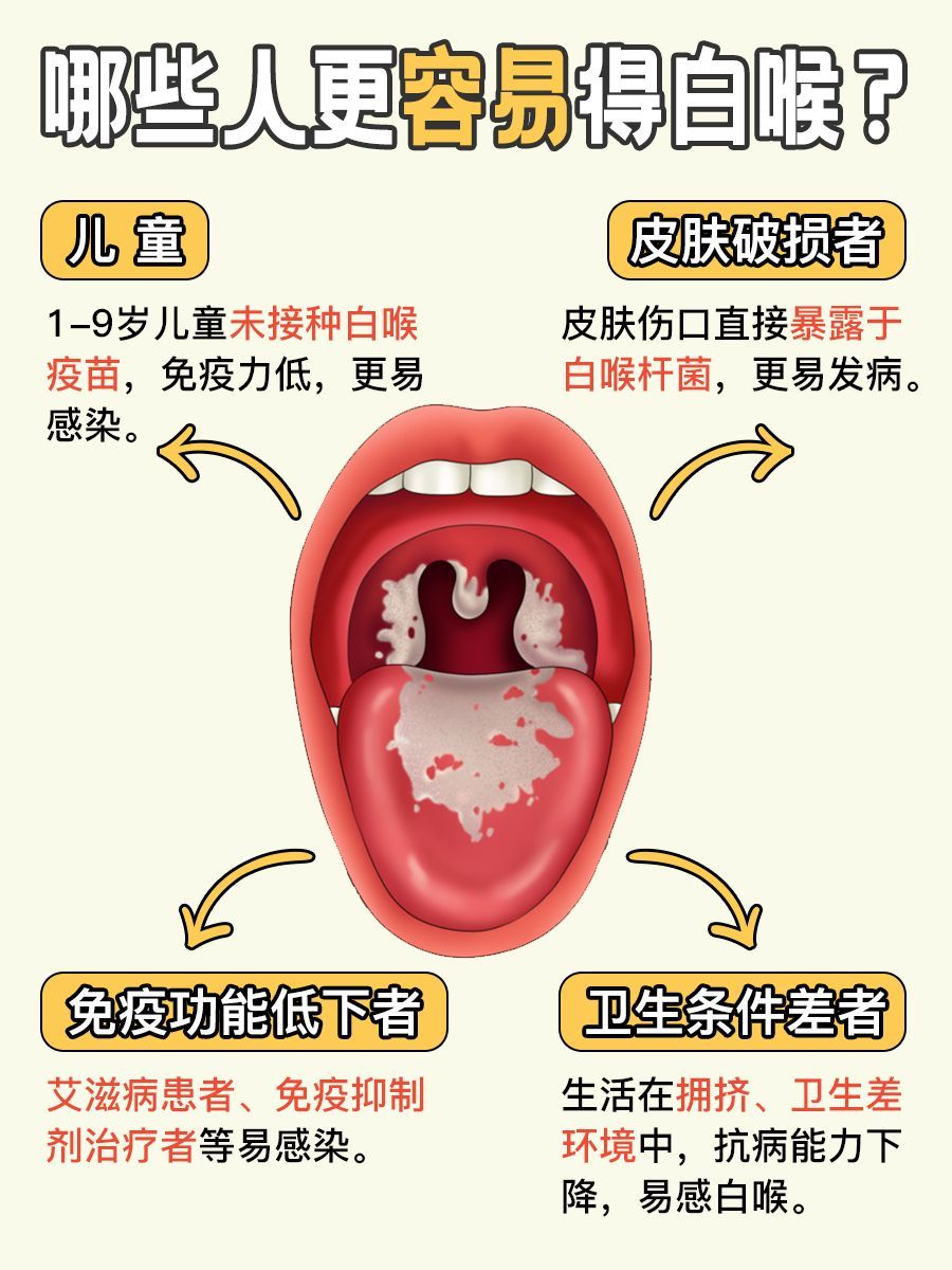 白喉是什么病？原来以前都想错了！