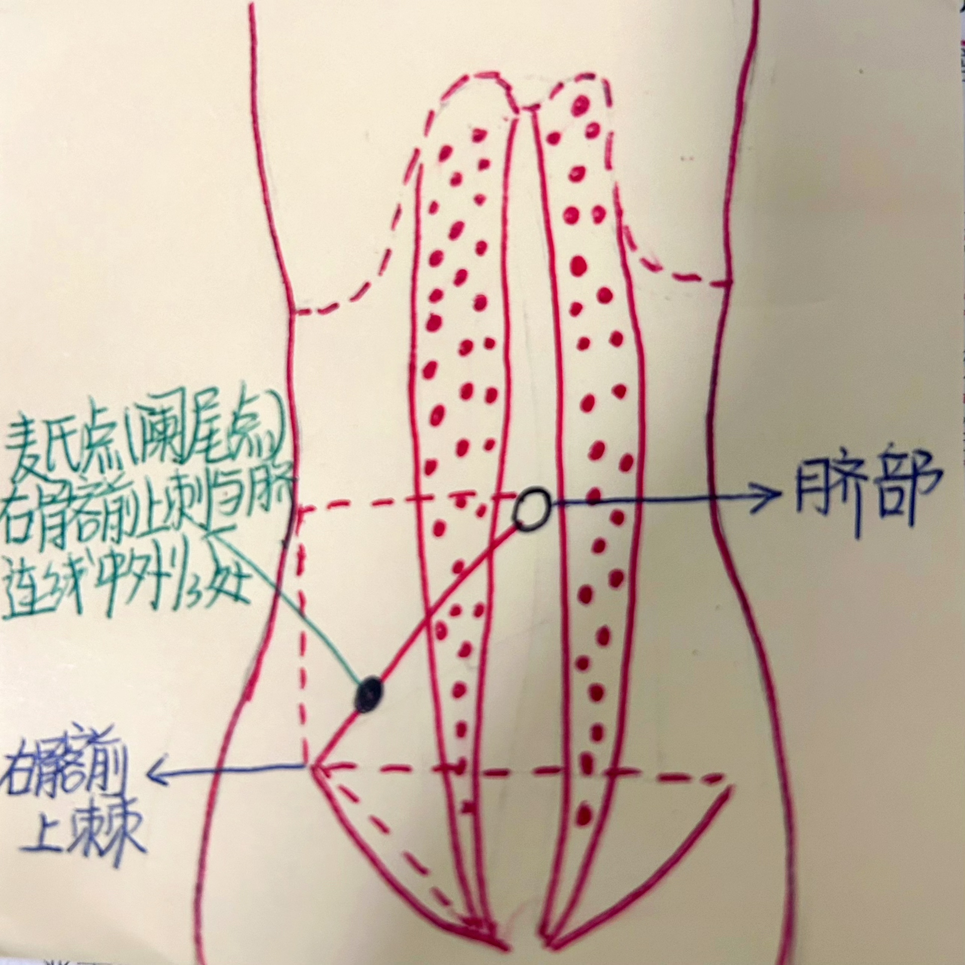 麦氏点定位图图片