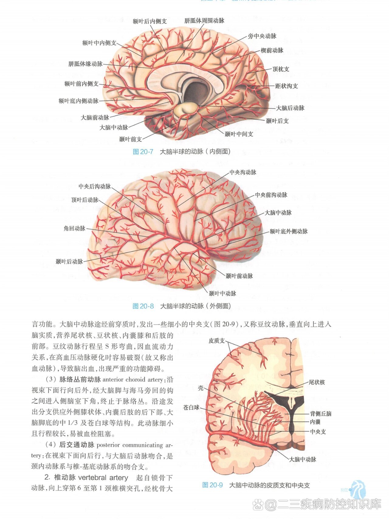 外侧豆纹动脉图片