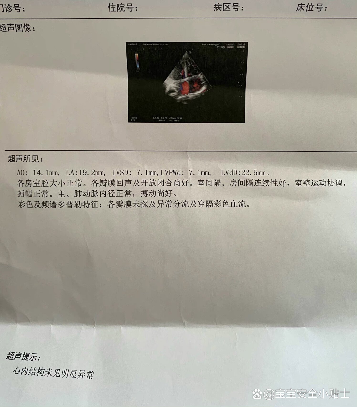 一周岁先心宝宝房缺室缺自愈