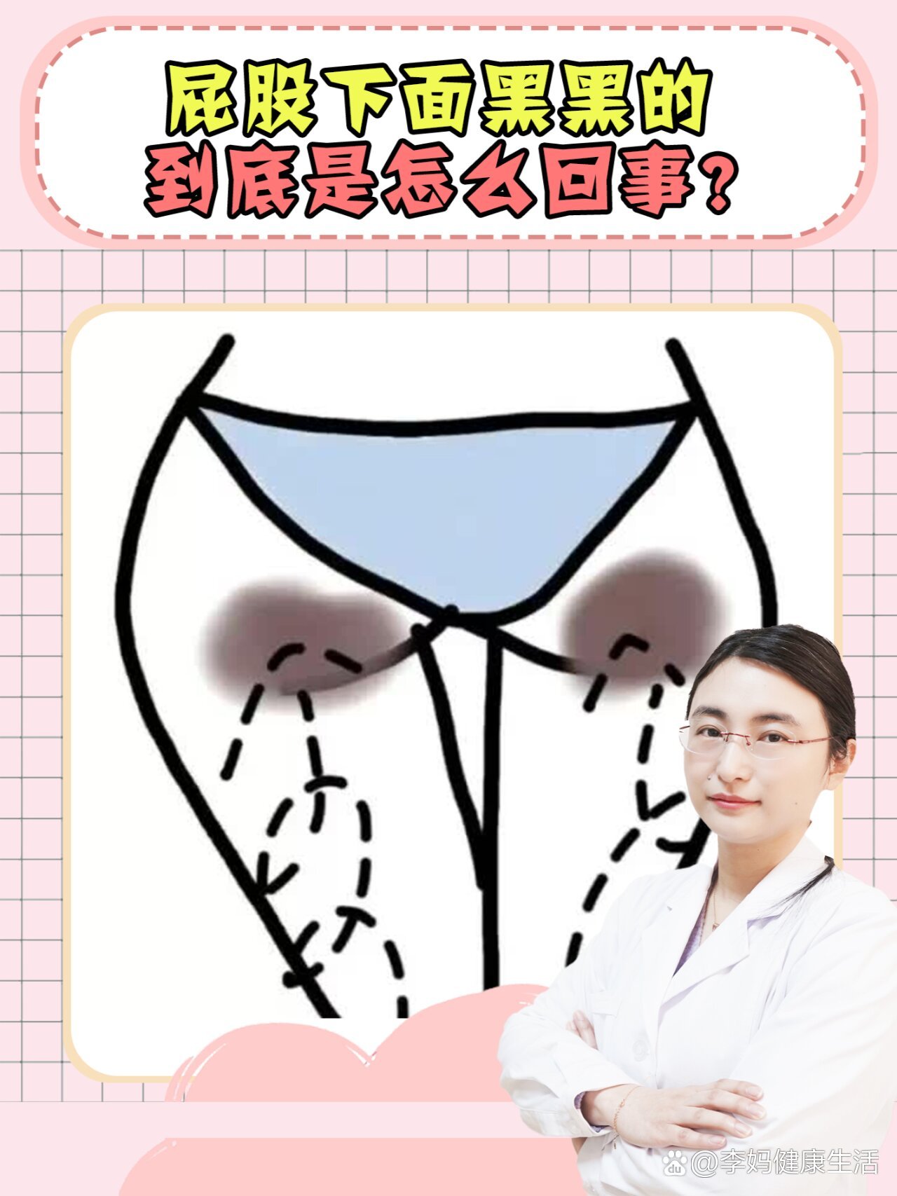 女孩子屁股下面黑黑的怎么办?