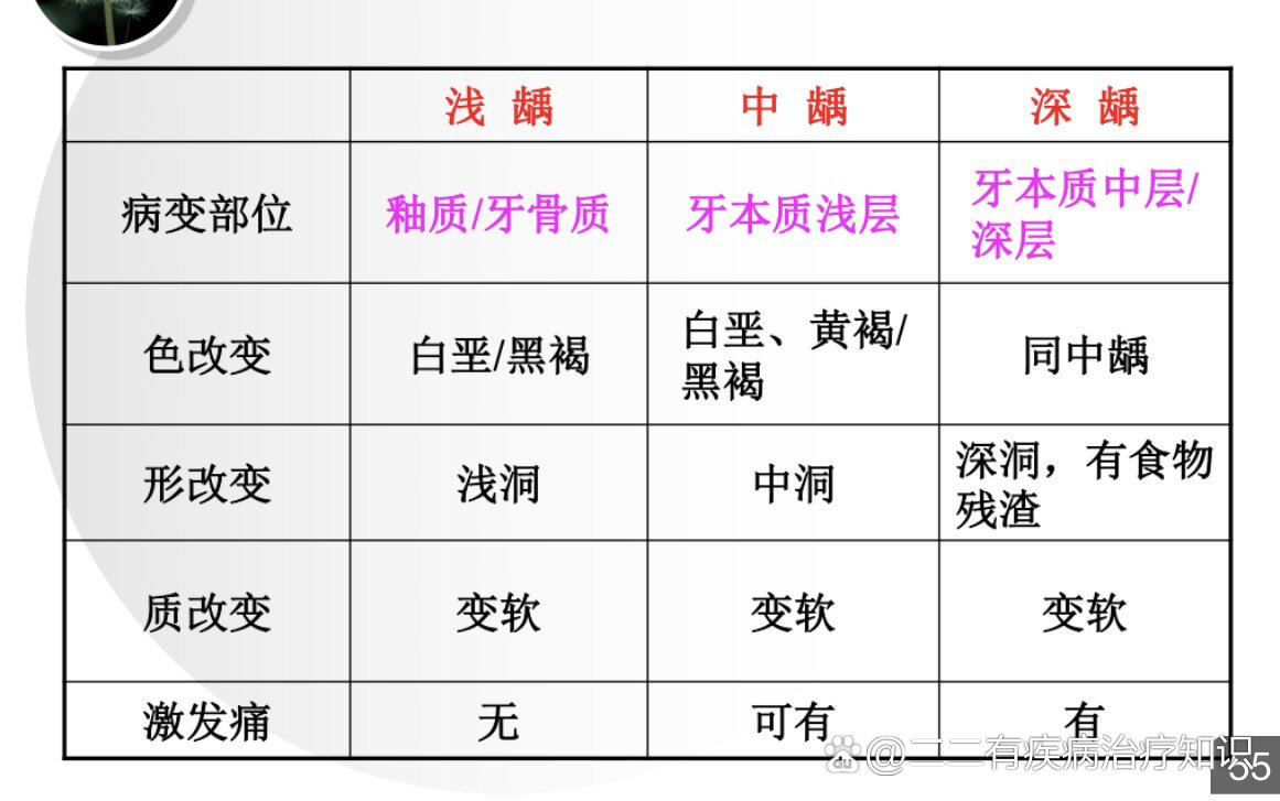 怎么区分浅龋中龋深龋图片