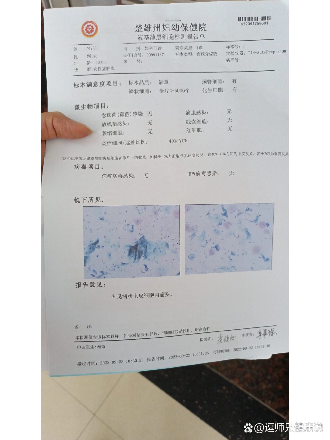 宫颈癌筛查的两张单子