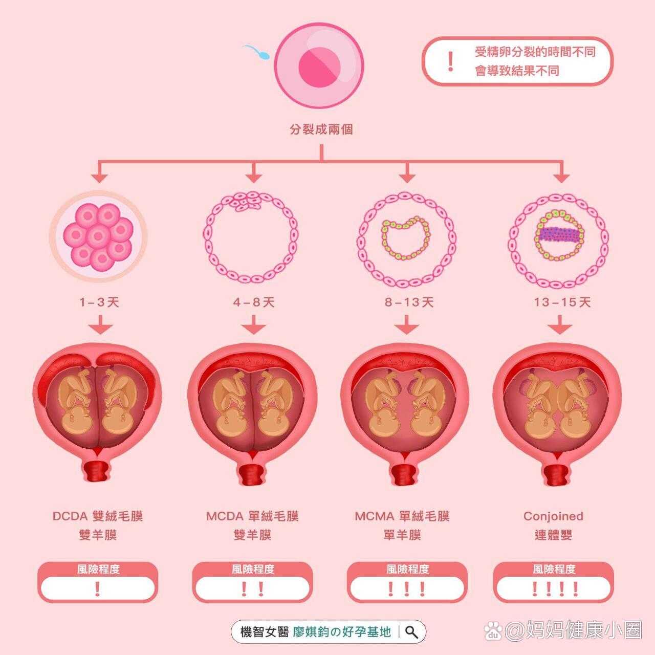 双胎妊娠:绒毛膜性质