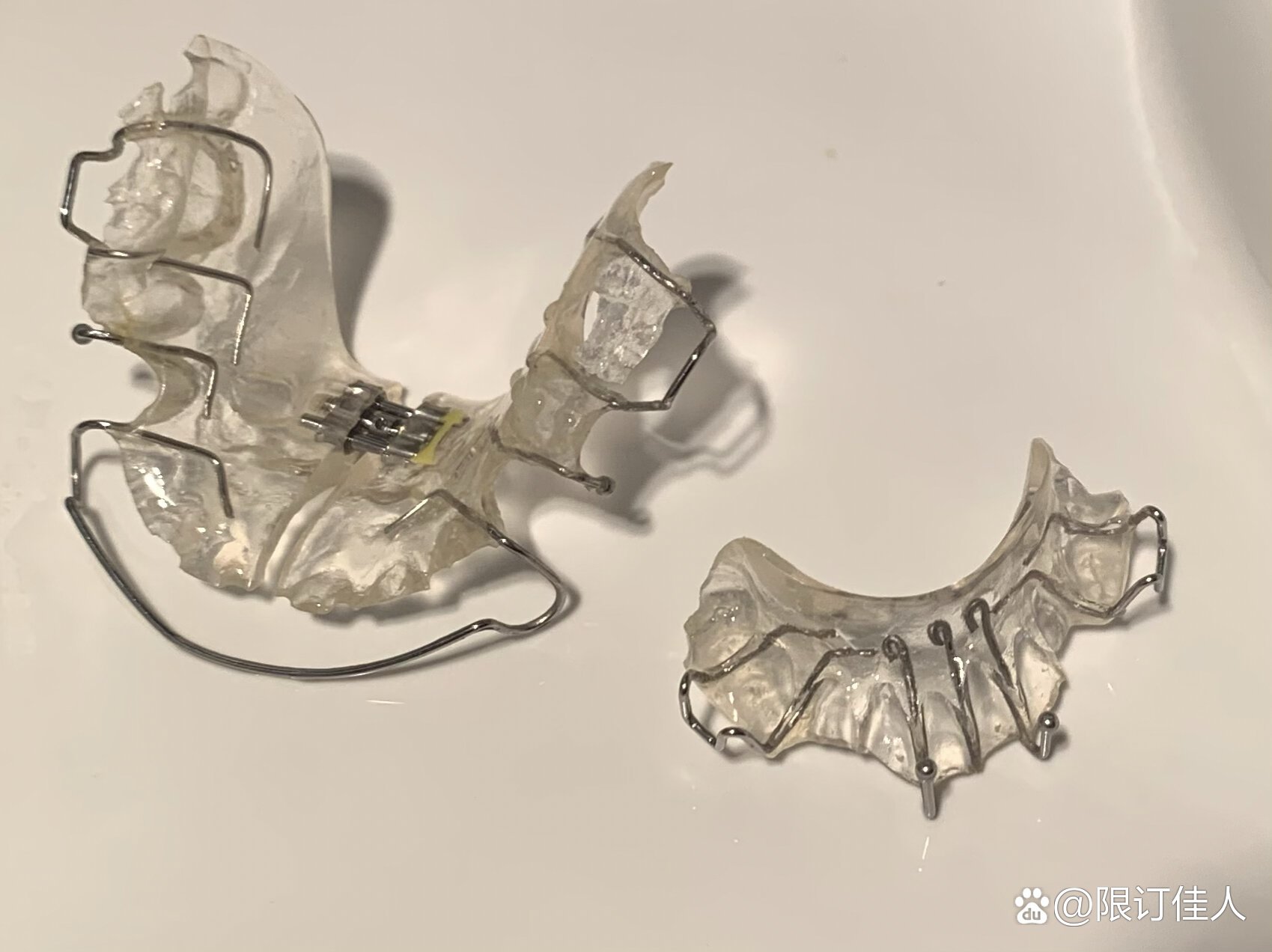 27岁老阿姨佩戴twin-block功能矫治器