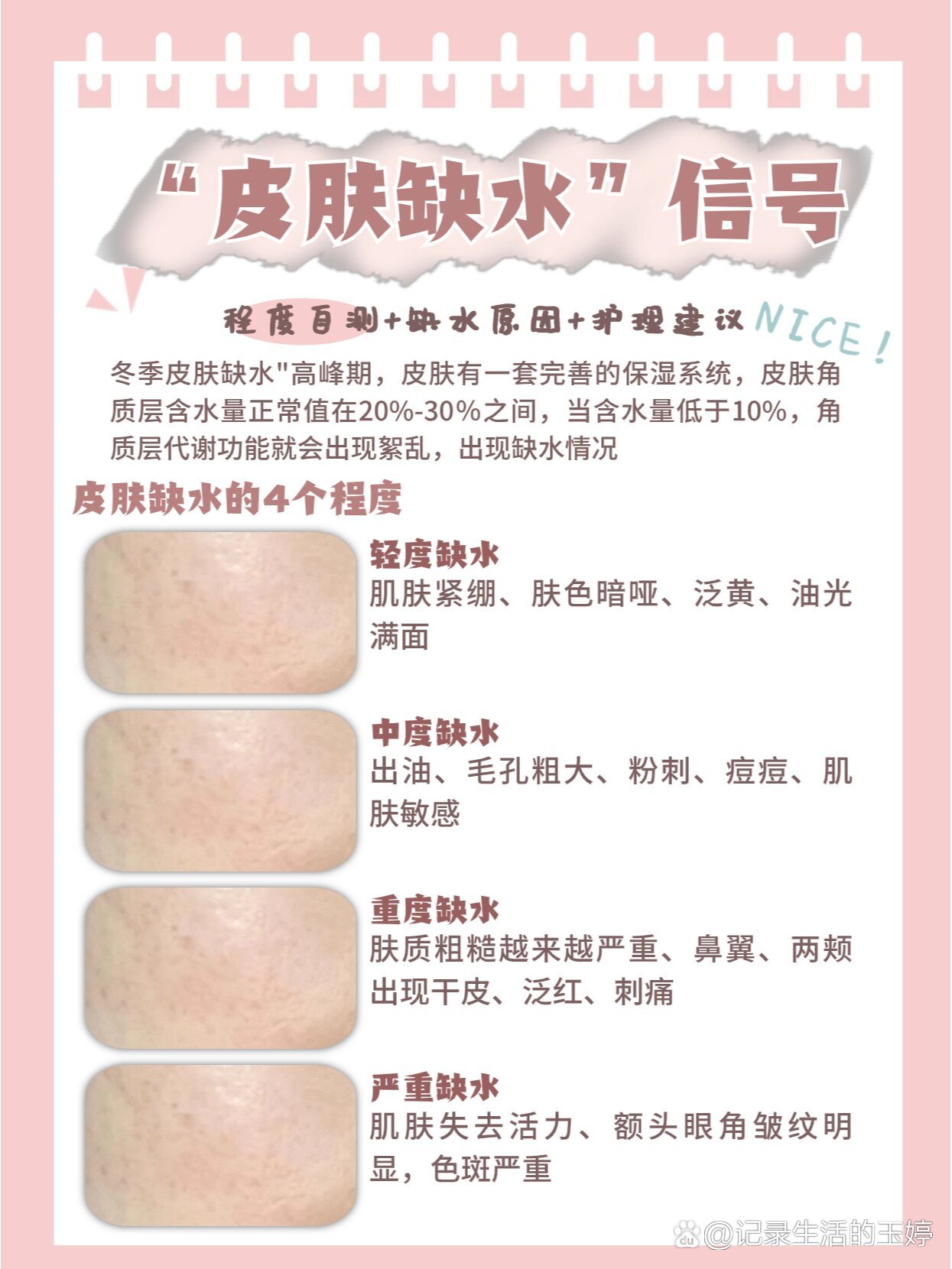 脸部有灼烧感,发痒泛红的宝贝们!