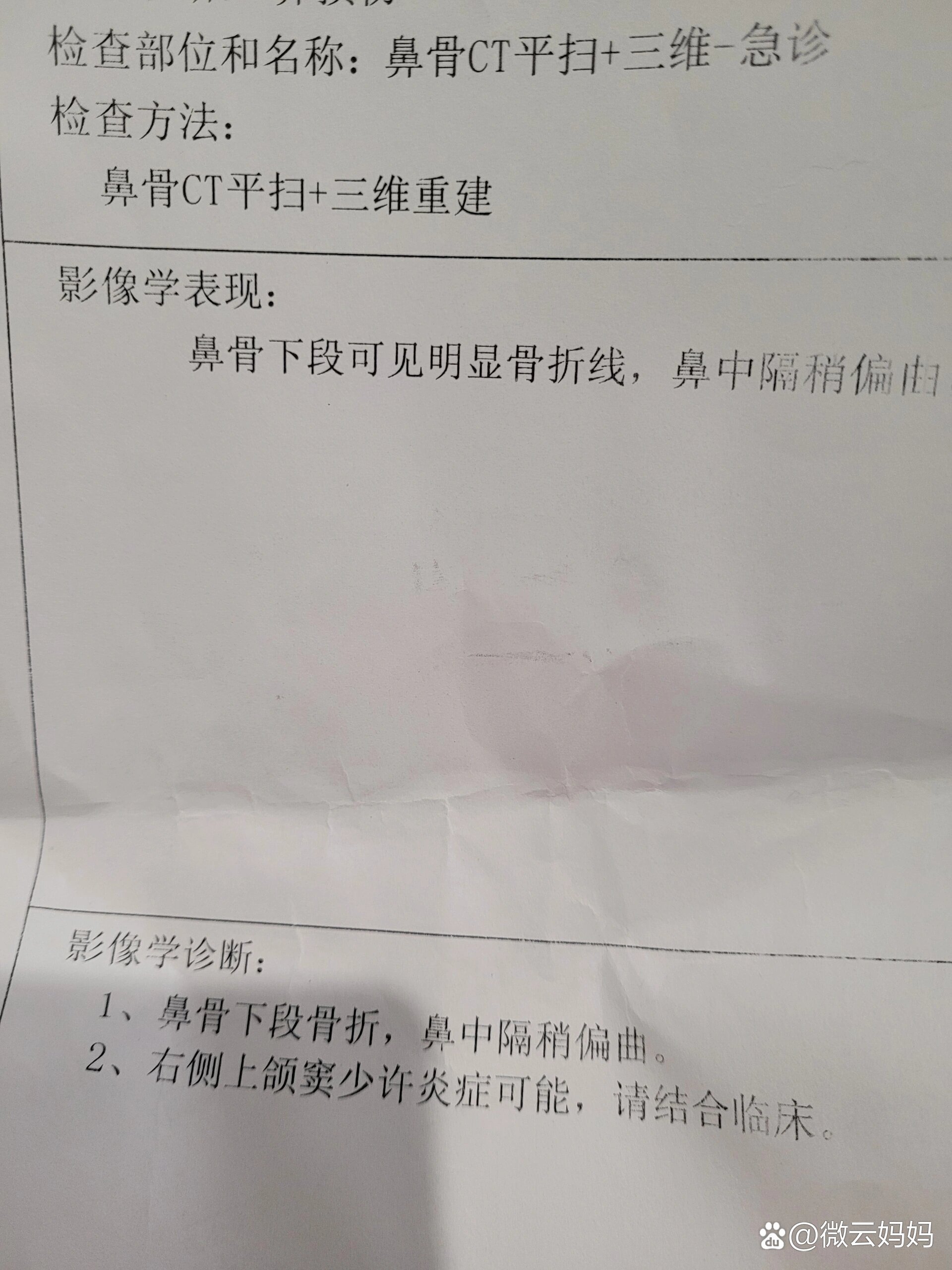 鼻骨骨折治疗流程