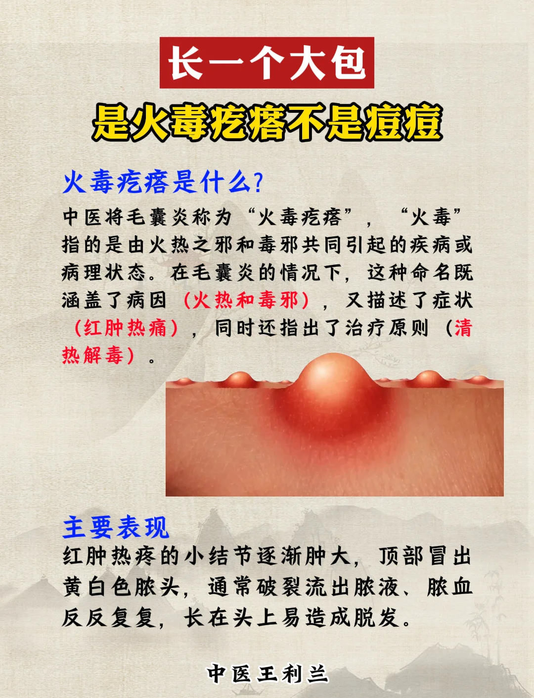 火毒疙瘩是什么？