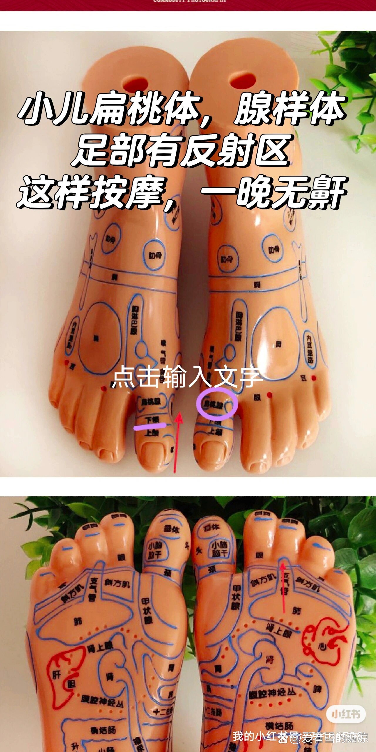 小儿扁桃腺样体大,这样推拿,睡觉无鼾