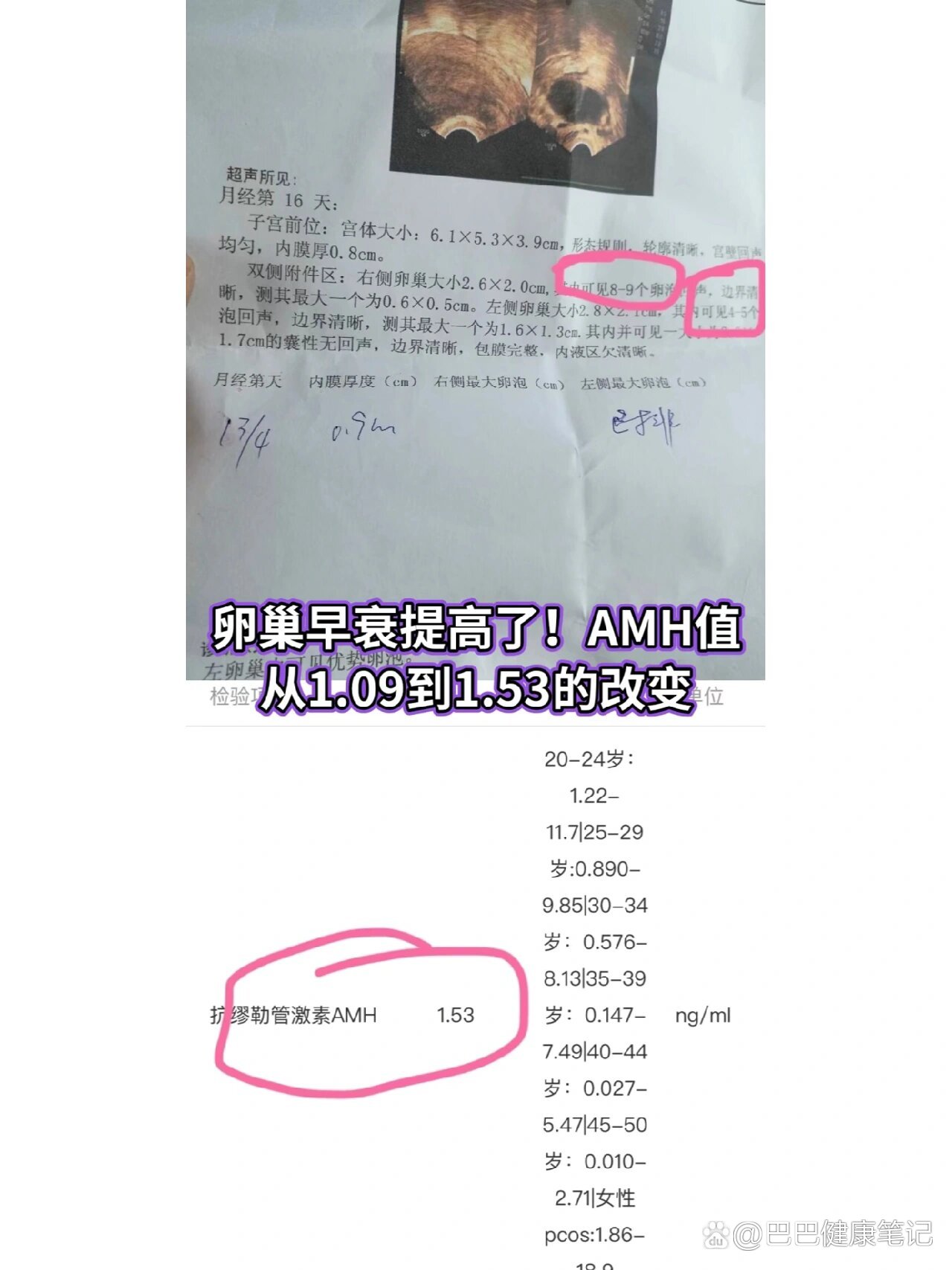 amh结果图图片