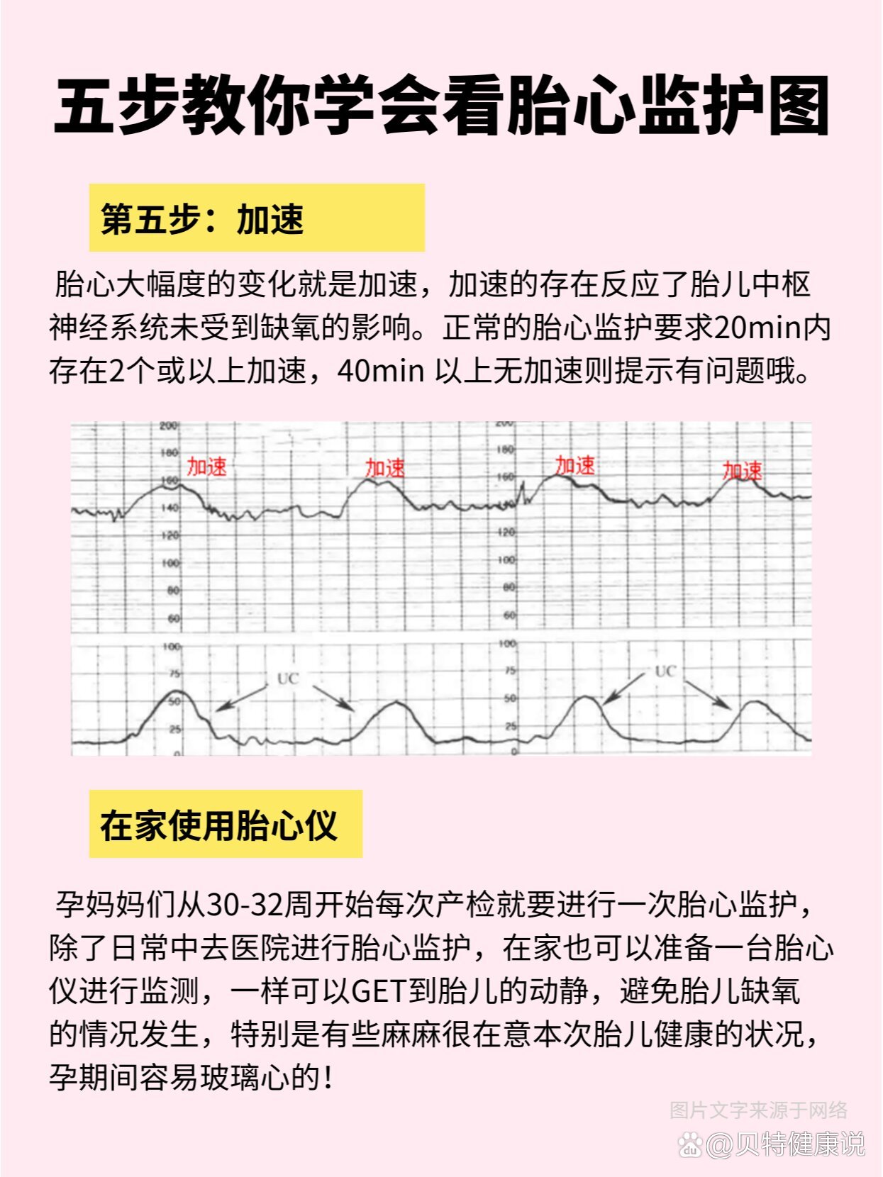 五步带你学会看胎心监护|手把手教程来啦!