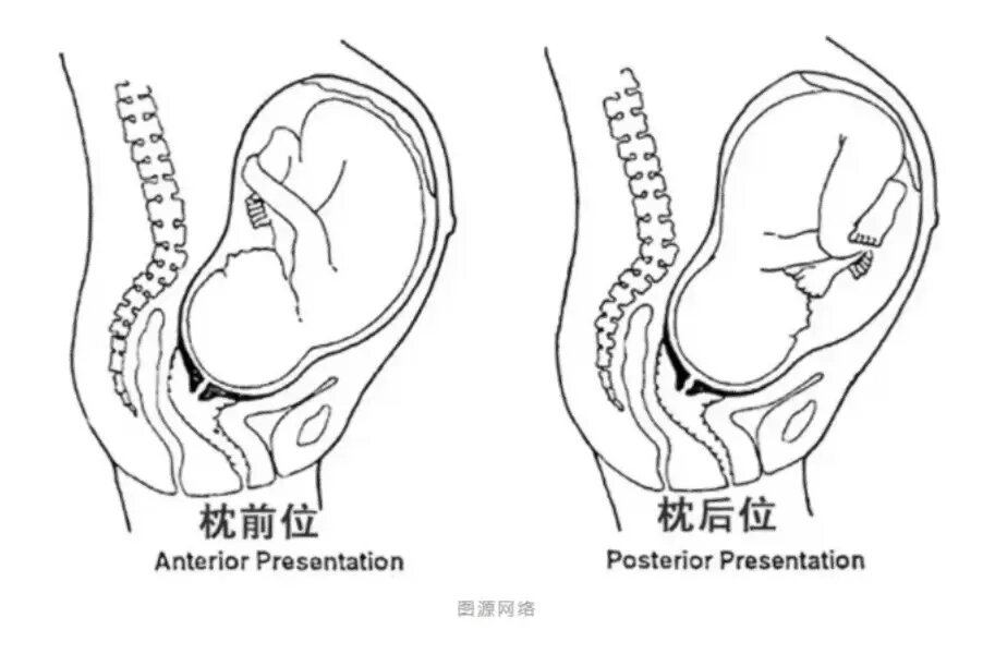 宫口迟迟不开 br>下午1点20人工破水,3点手动转胎,3点半顺产宝宝… br