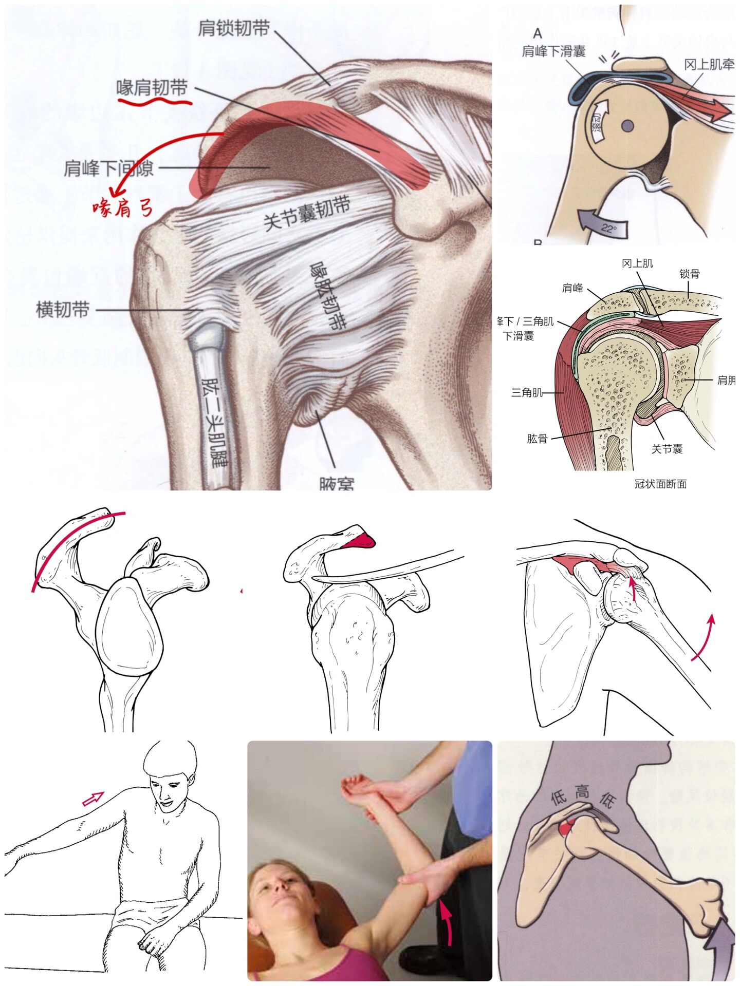 棘间韧带作用图片