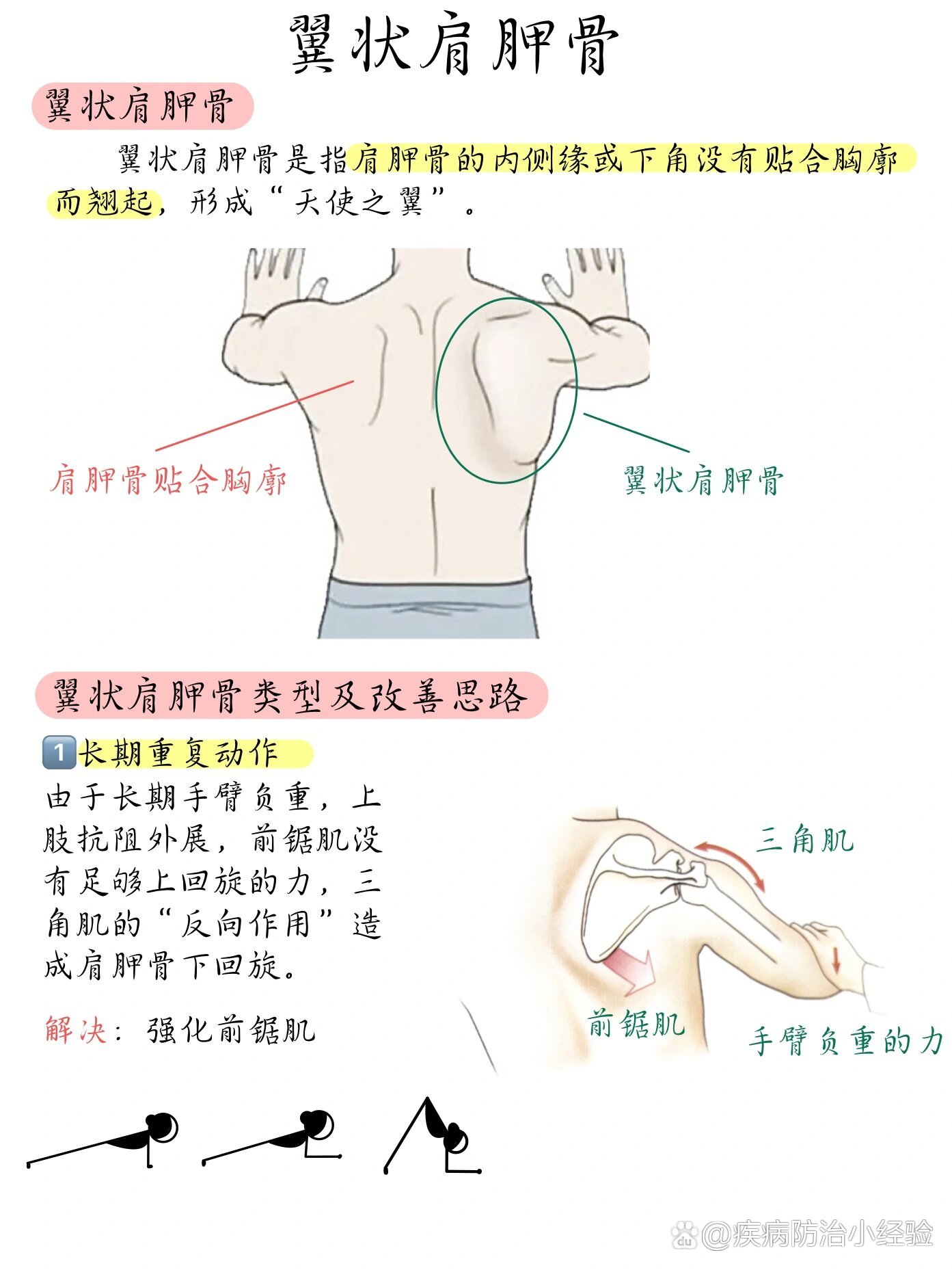 肩胛骨的六个方向图解图片