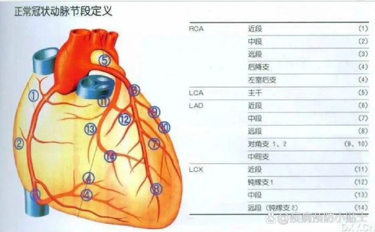 回旋支位置图片