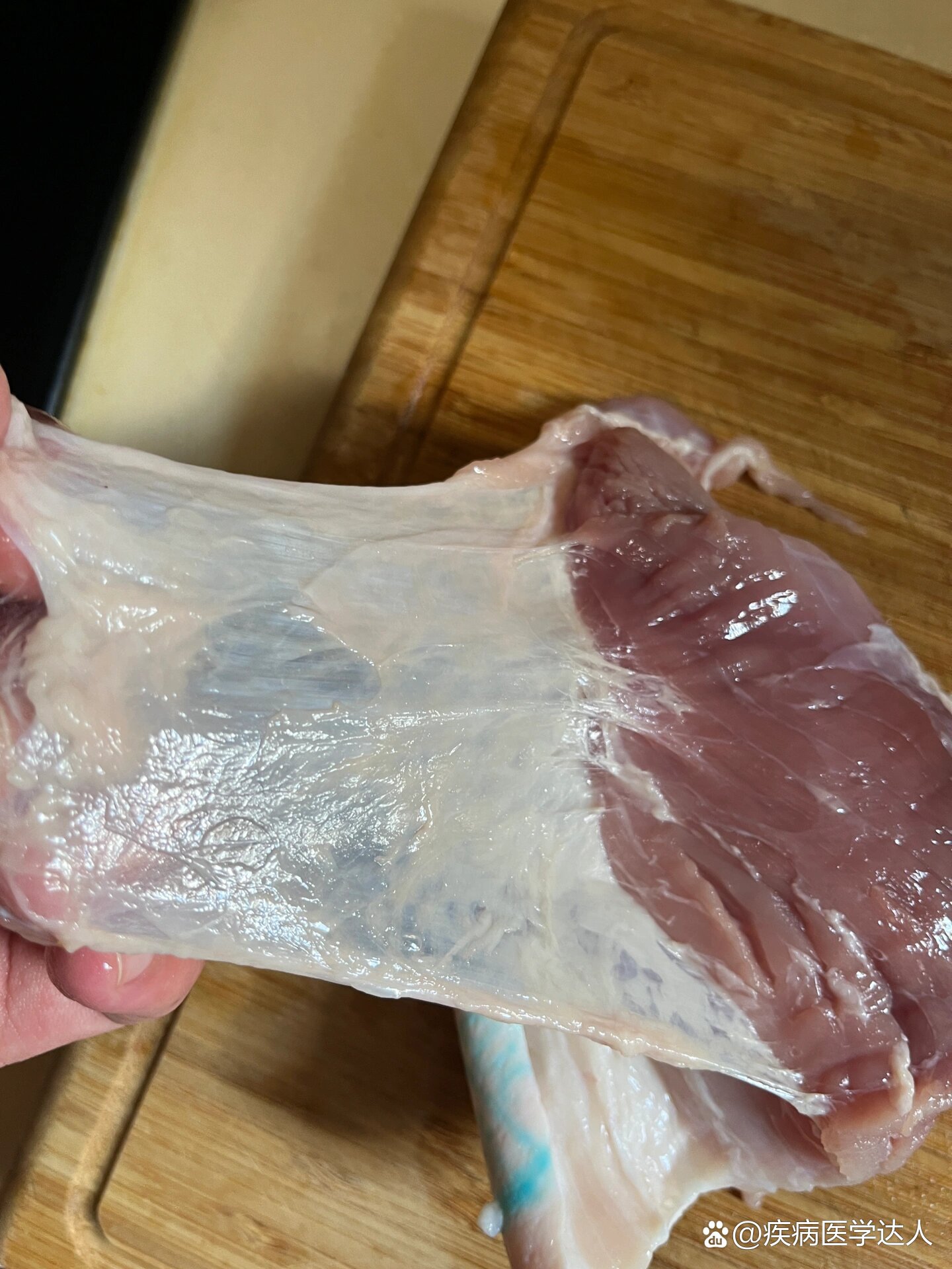 筋膜与肌肉的关系