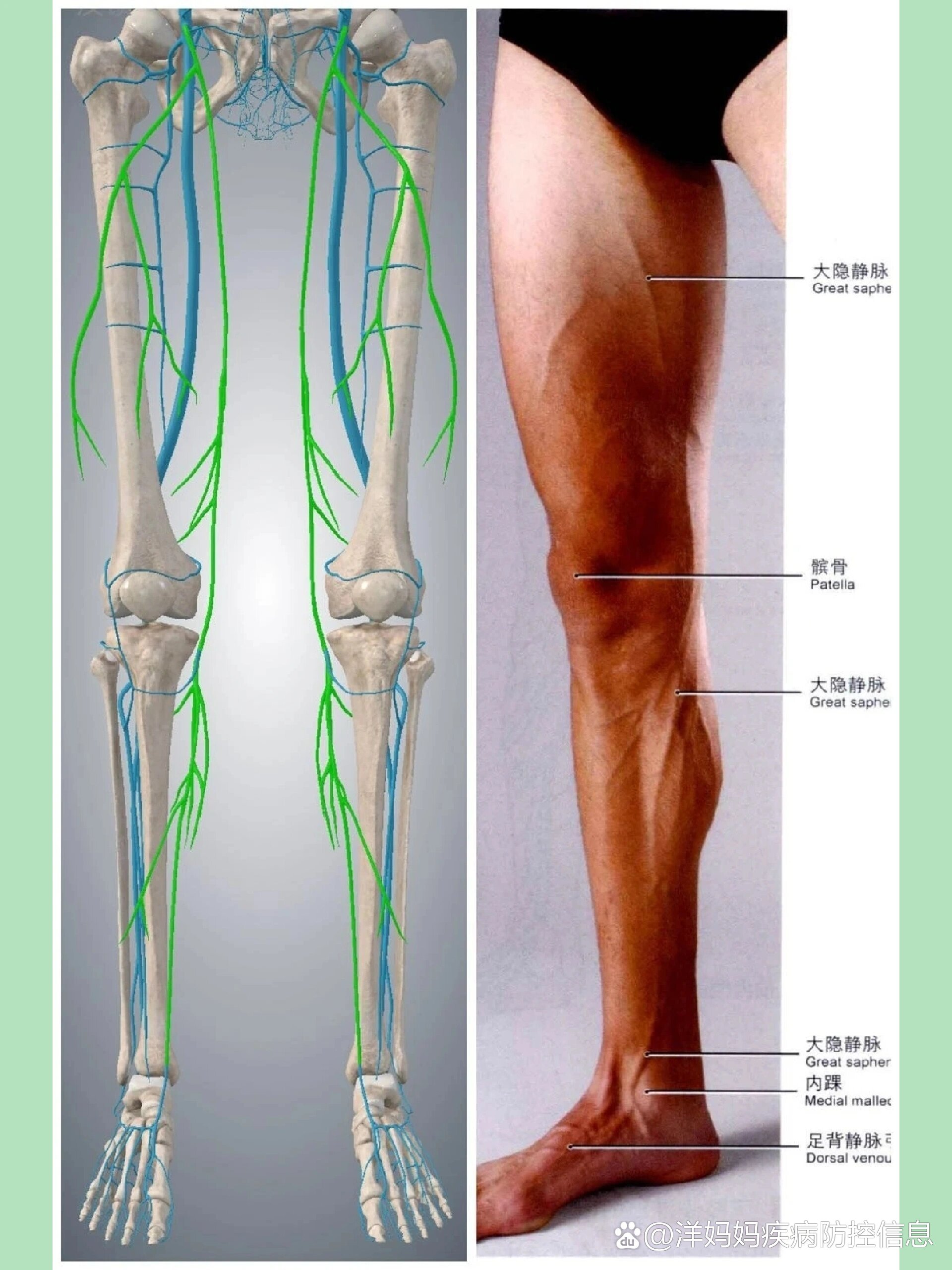 下肢深静脉解剖图谱图片