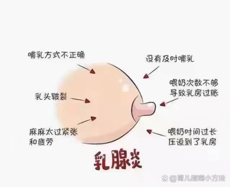 切除乳房母乳喂养图片