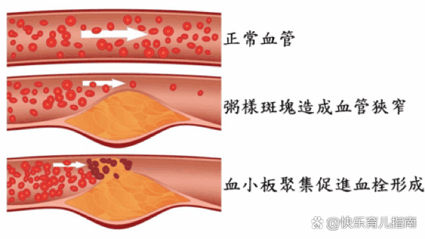 凝血症图片图片