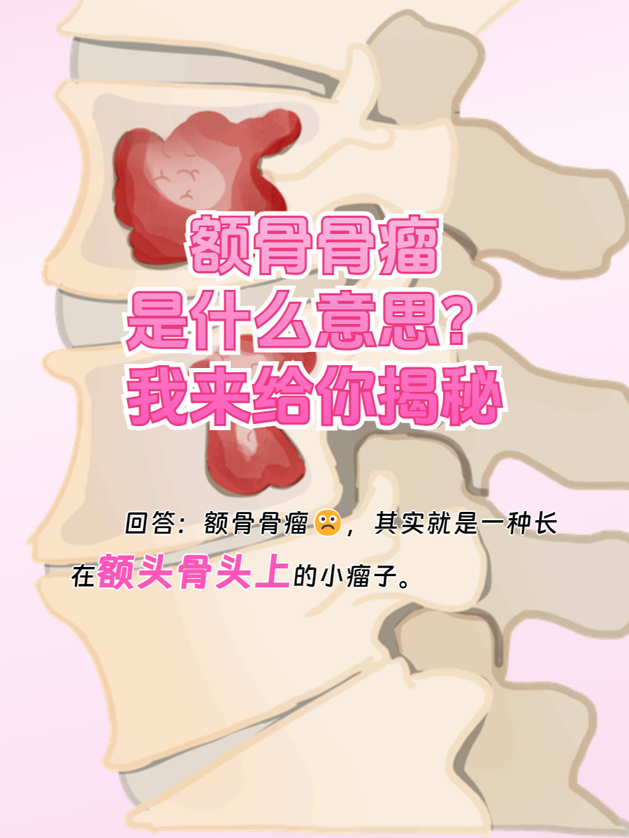 额骨骨瘤是什么意思?我来给你揭秘!