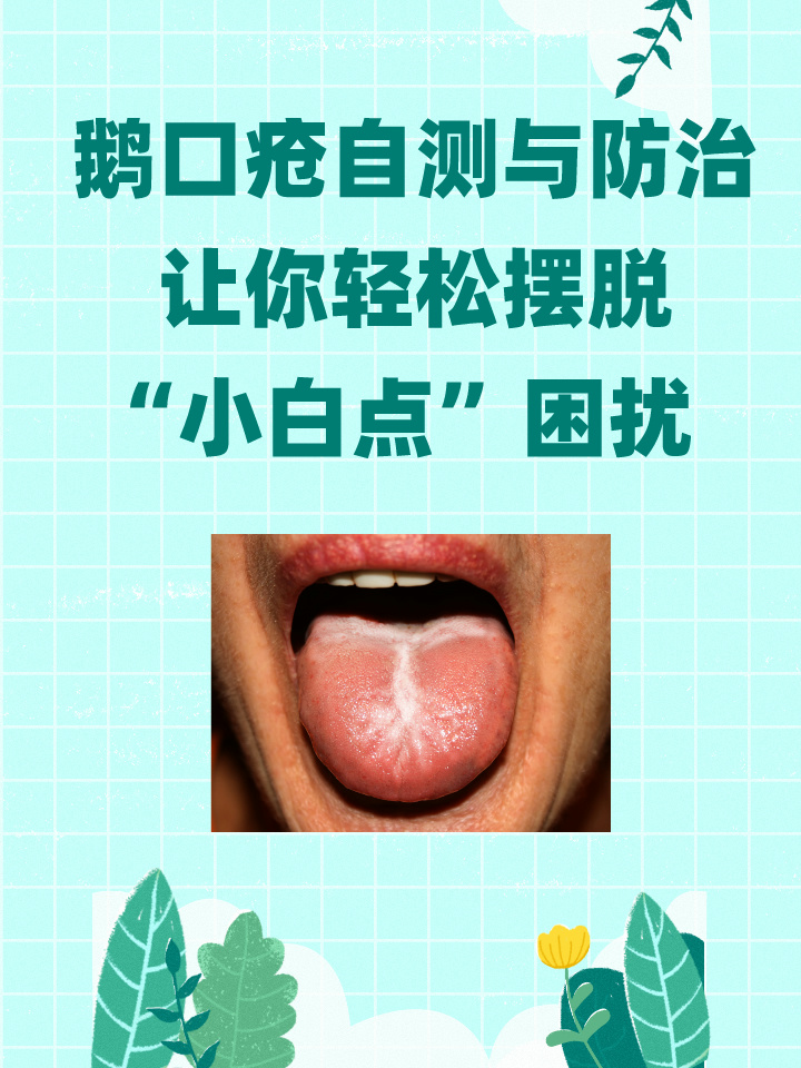 白苔与鹅口疮区分图片图片