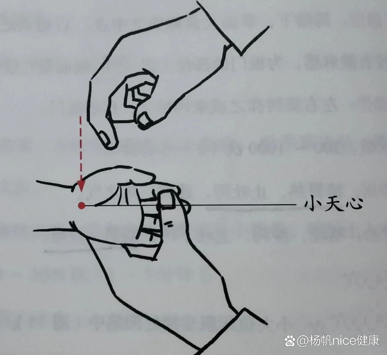  p>小儿推拿常用穴位 | 小天心 br>小天心  br>部位:掌根,大小鱼际