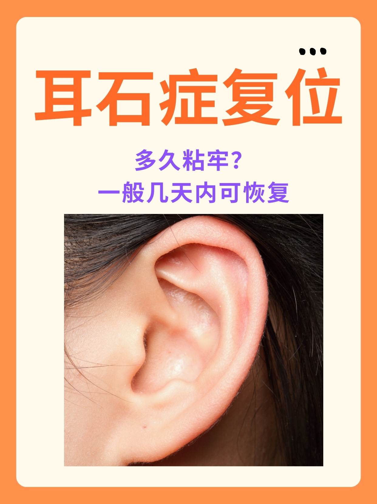 耳石症怎么治图片