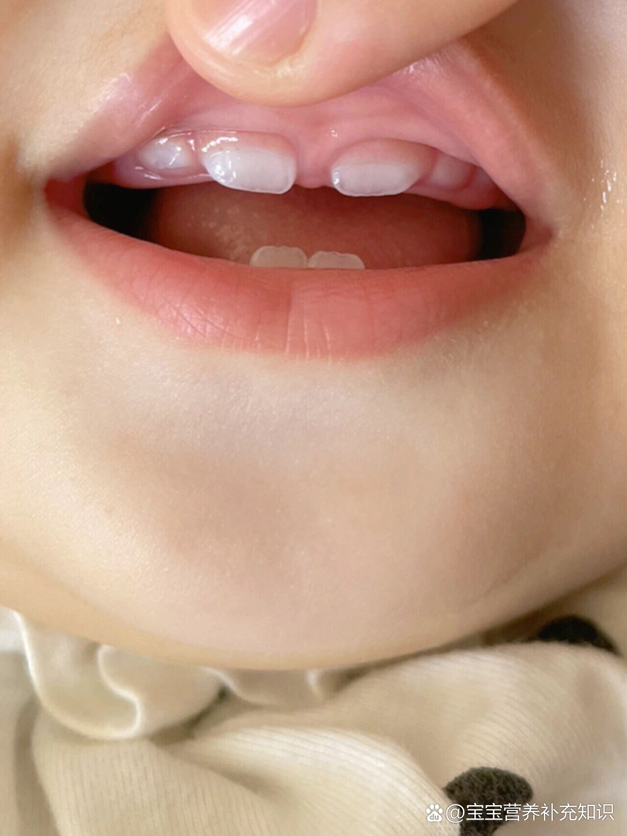 整,一共出了五颗牙,下面两颗牙齿是最先出的,然后长了上边的两颗门牙