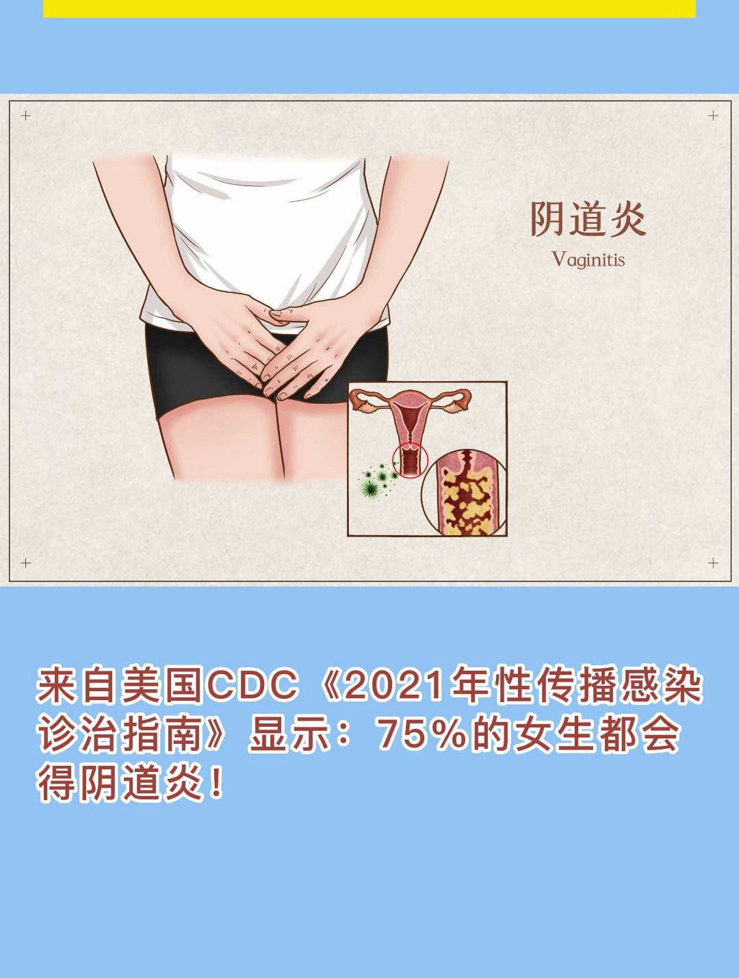 阴道 