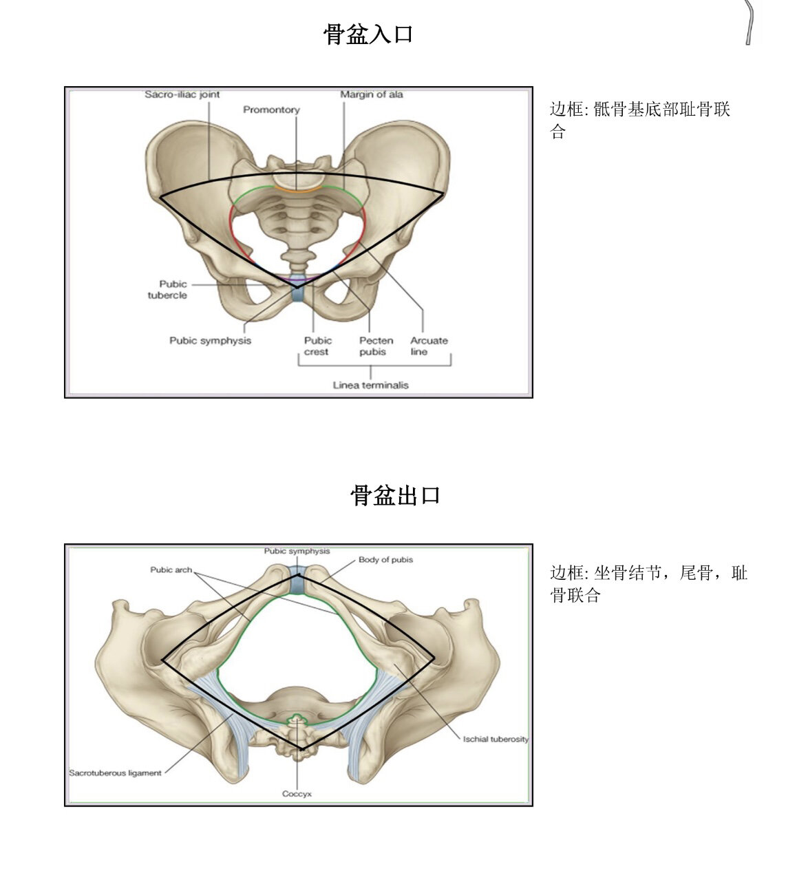 骨盆下口图片图片